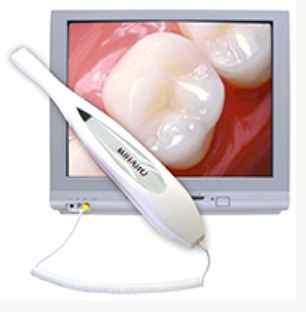 intraoral Cameras
